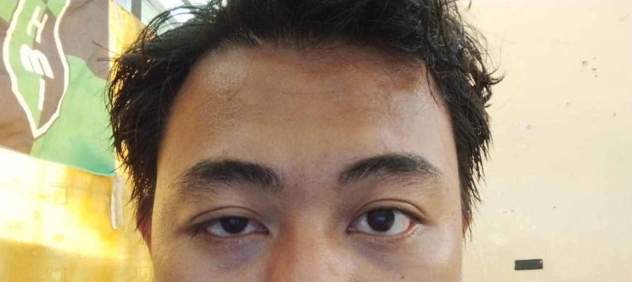 Ketua HMI FKIP Unmul Dipukul Saat Aksi Tolak Penggusuran Pasar Subuh, Mata Lebam Akibat Represi Aparat